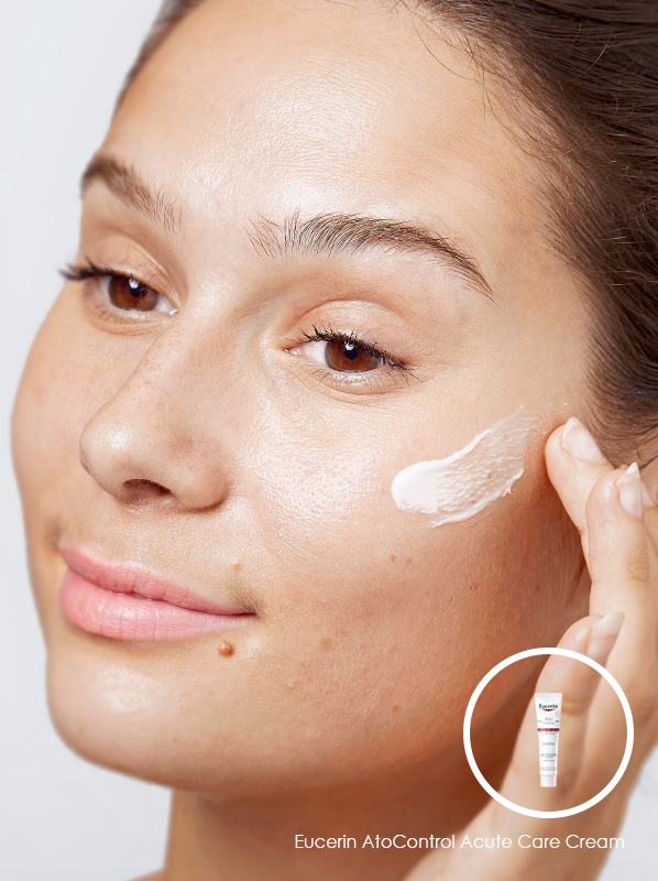 Itchy Skin Solutions; Eucerin AtoControl Acute Care Cream