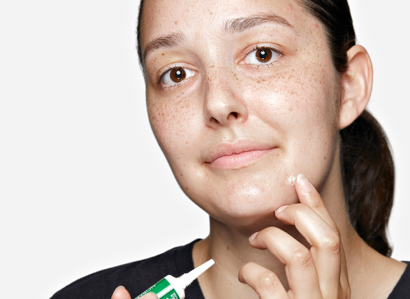 Does stress cause skin breakouts?