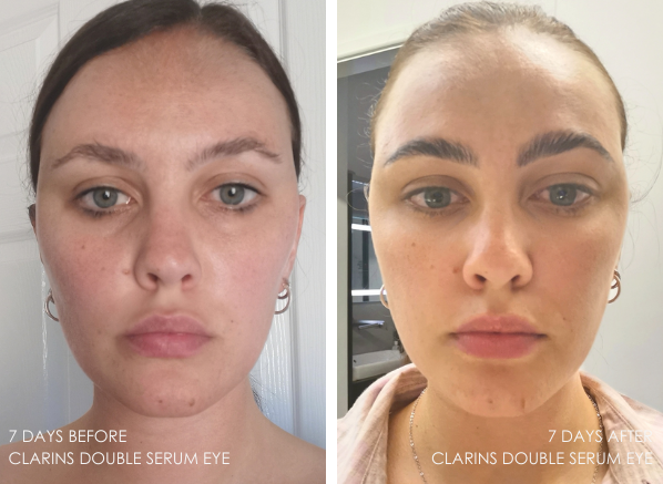 Clarins Double Serum Eye The Results Escentual S Blog