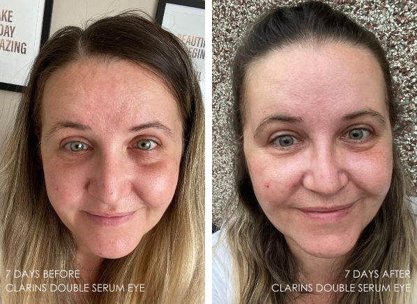 Clarins Double Serum Eye The Results Escentual S Blog