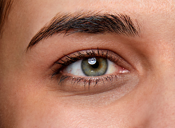 What Causes Dark Circles And How To...