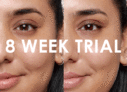 Vida Glow 8 Week Trial: See Our Results